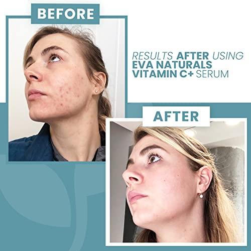 Eva Naturals Vitamin C Face Serum with Hyaluronic Acid